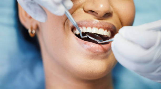 Best Emergency Dental Care for Sports Injuries in Massanutten, VA