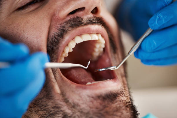 Best Urgent Dental Care for Toothaches in Massanutten, VA